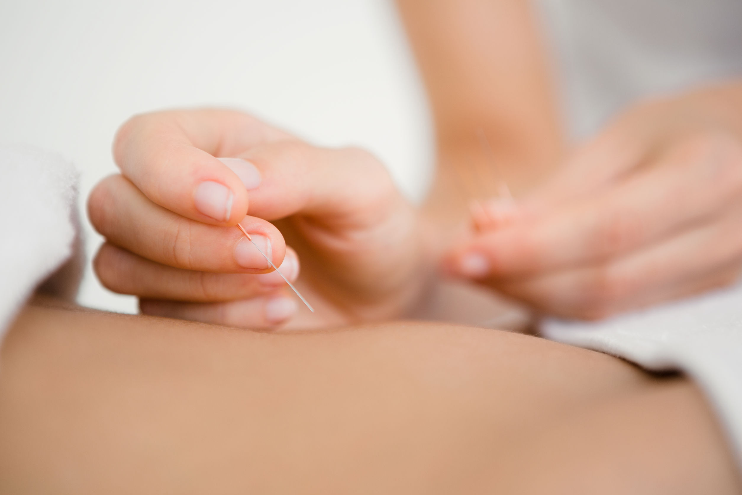 sage-femme acupuncteur